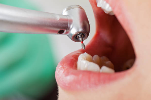 Best Emergency Treatment for Toothache in Kingston, NJ